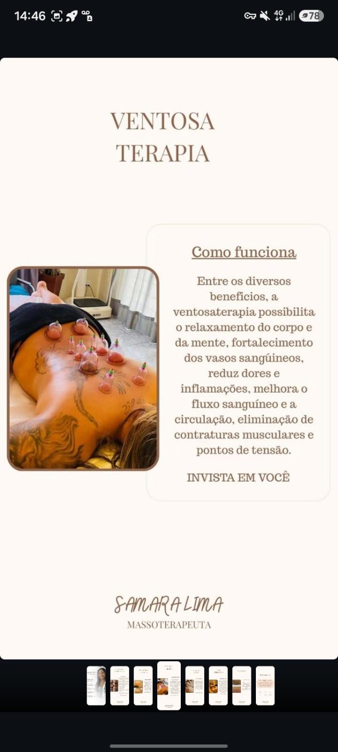 Ventosa Terapia